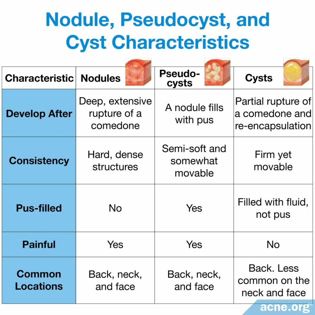 Nodule, Pseudocyst, and Cyst Characteristics