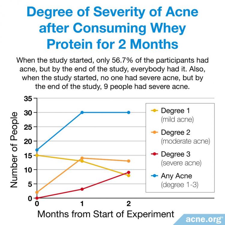 Degree of Severity of Acne after Consuming Whey Protein for 2 Months