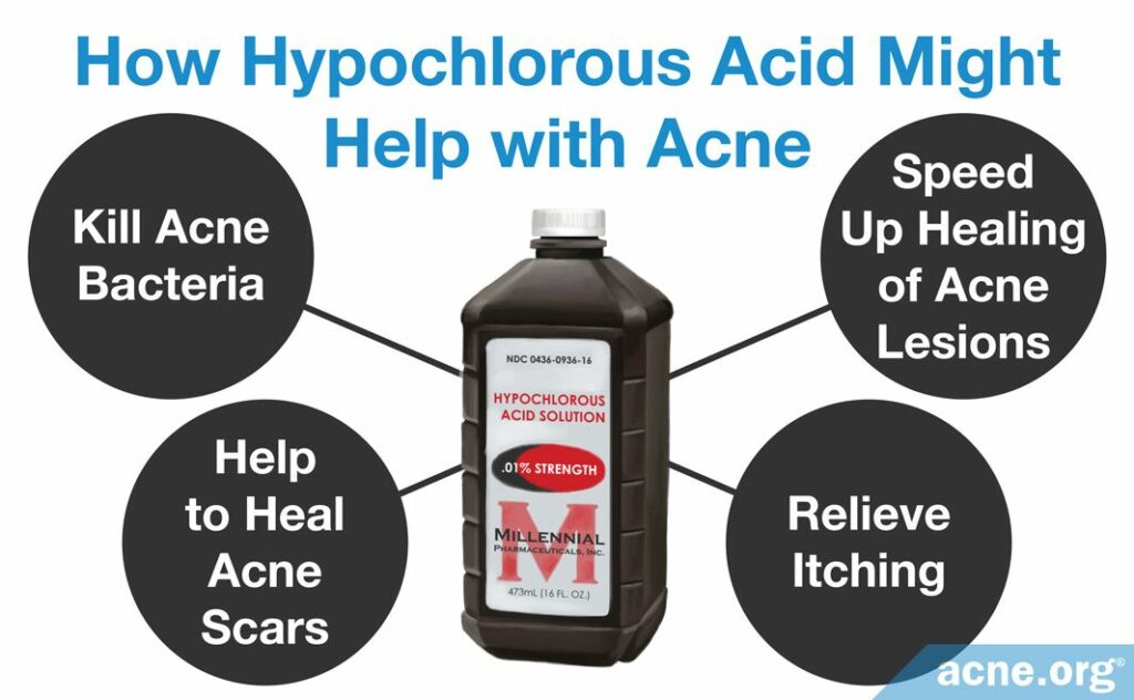 How Hypochlorous Acid Might Help with Acne