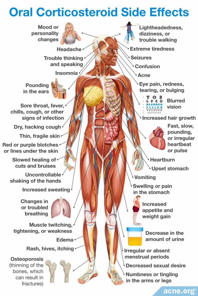 Oral Corticosteroid Side Effects