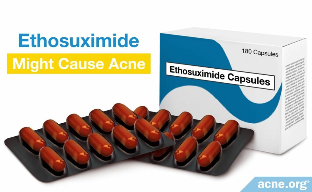 Ethosuximide Might Cause Acne