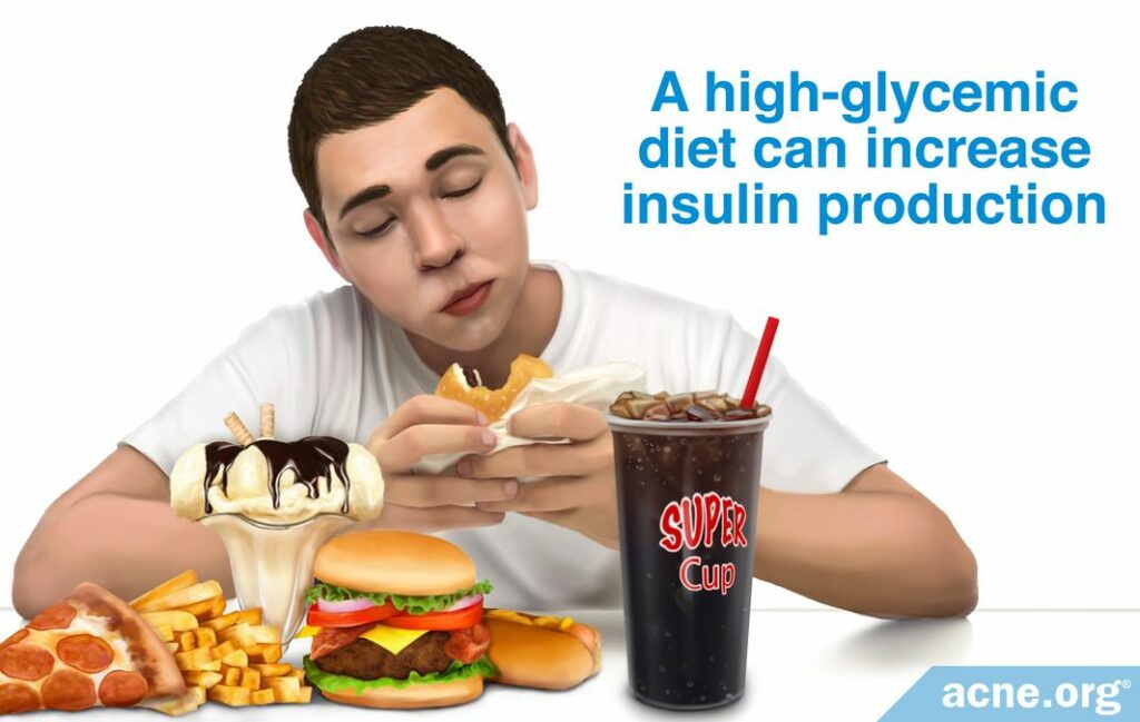 A High-glycemic Diet Can Increase Insulin Production