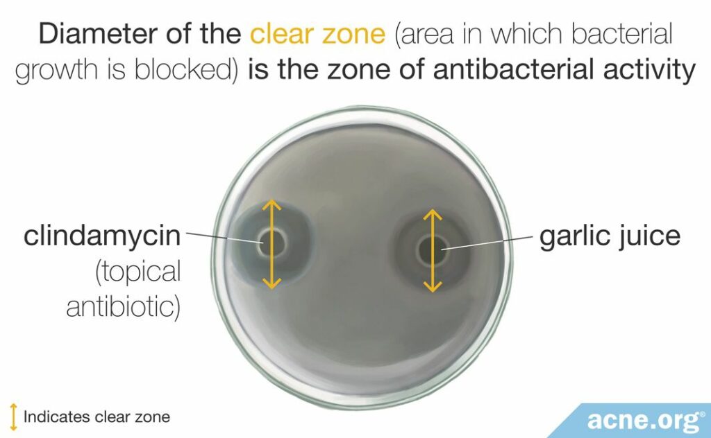 Diameter of the clear zone (area in which bacterial growth is blocked) is the zone of antibacterial activity