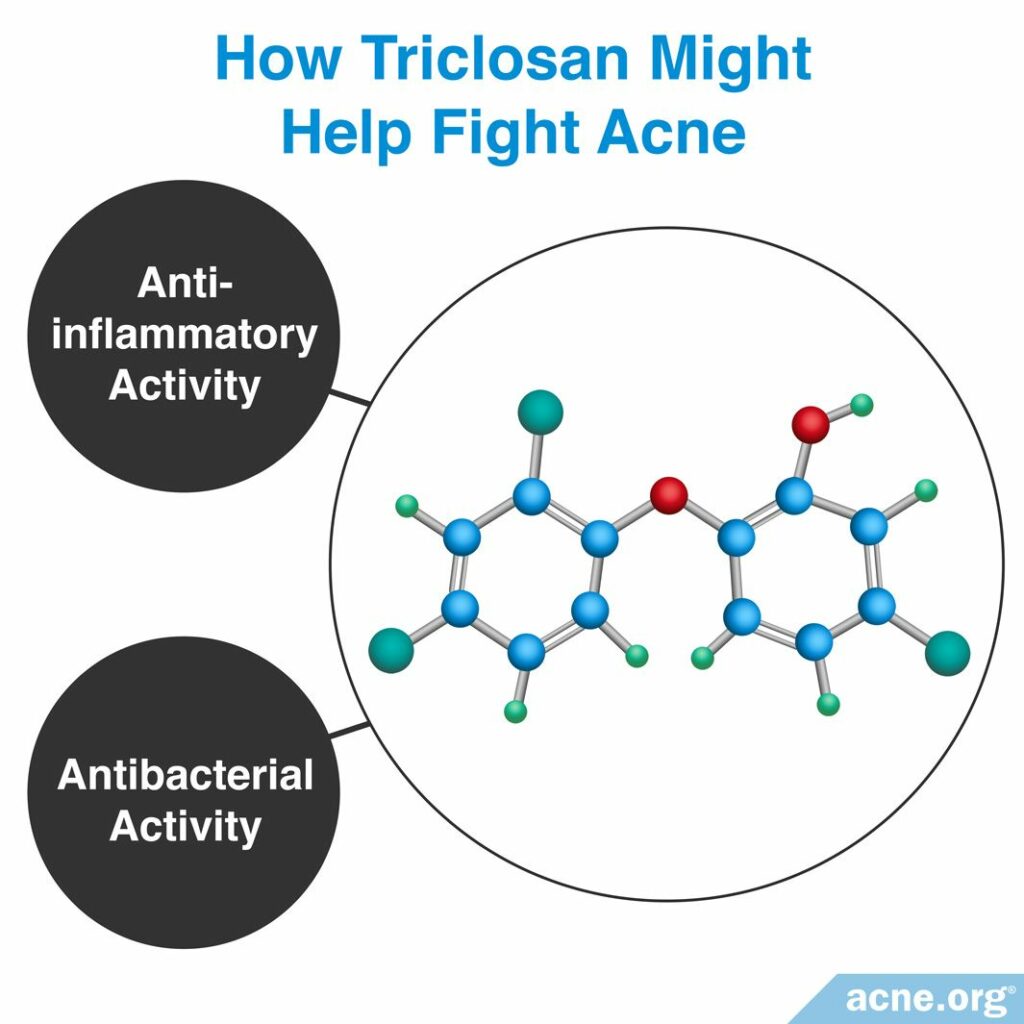 How Triclosan Might Help Fight Acne