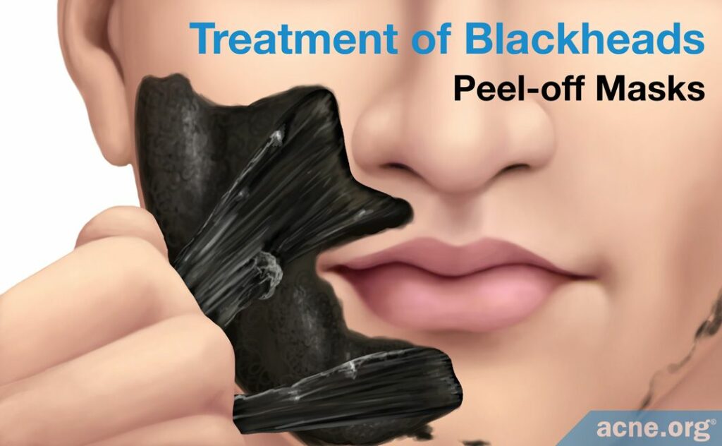 Treatment of Blackheads Peel-off Masks