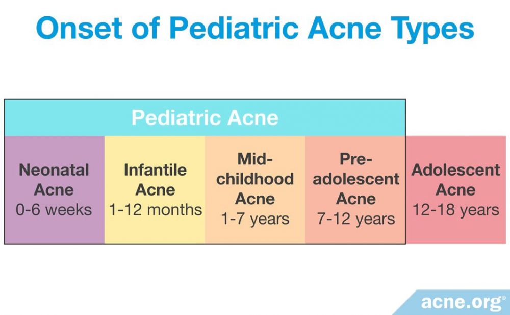 Onset of Pediatric Acne Types