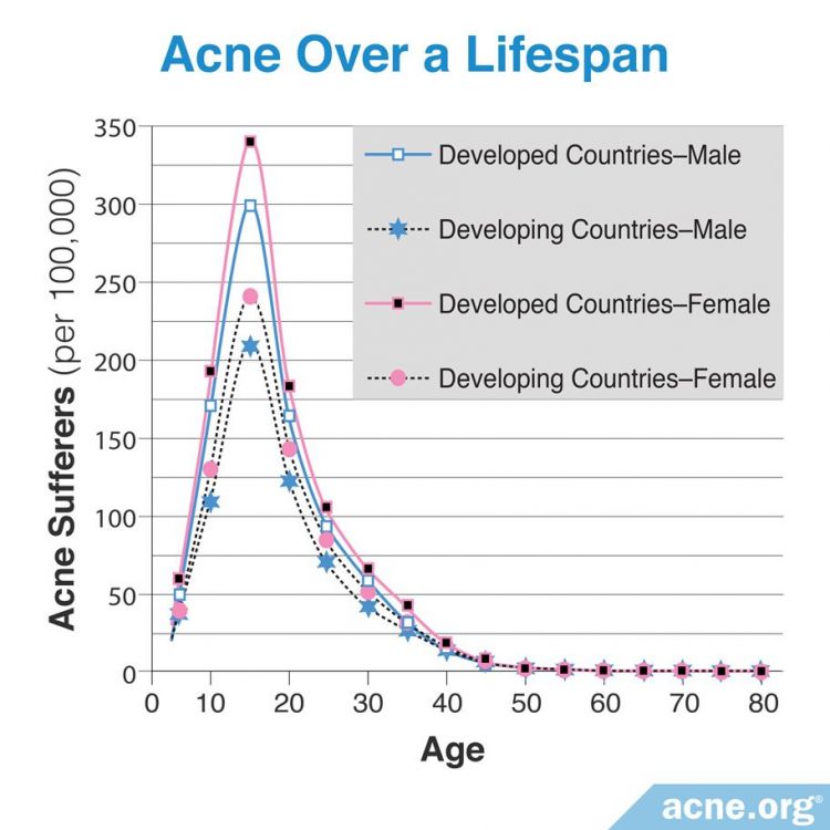 Acne over a lifespan