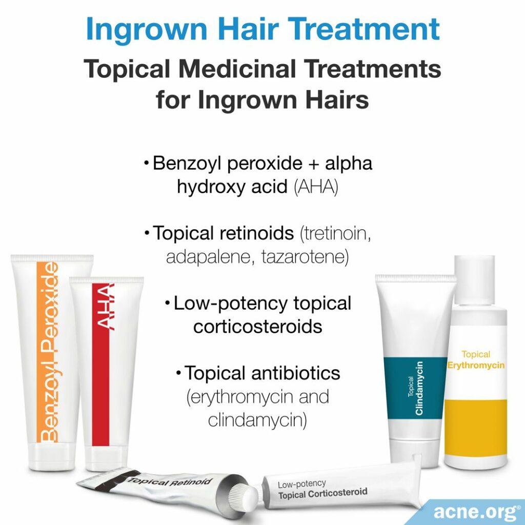 Ingrown Hair Treatment Topical Medicinal Treatments for Ingrown Hairs