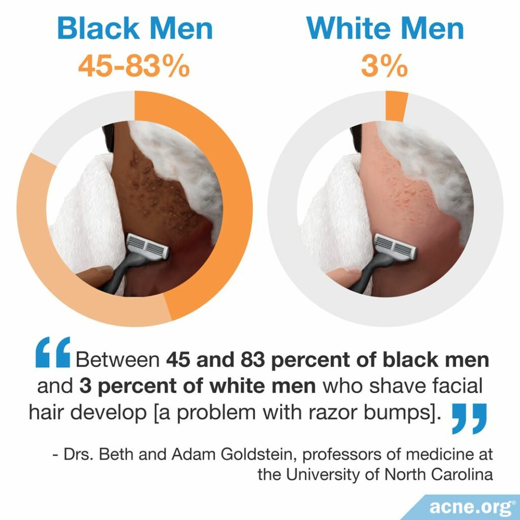 Between 45 and 83 percent of black men and 3 percent of white men who shave facial hair develop a problem with razor bumps
