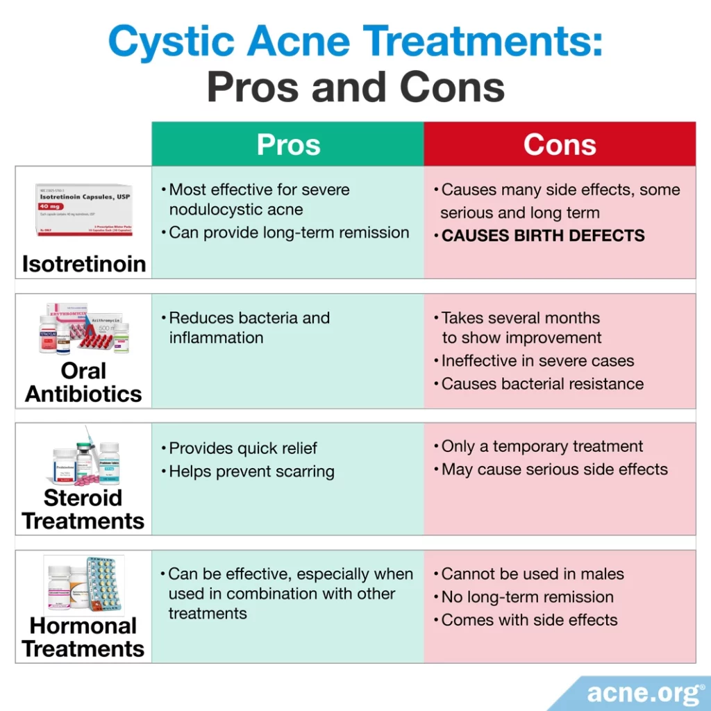 Ventajas y desventajas de los tratamientos para el acné quístico