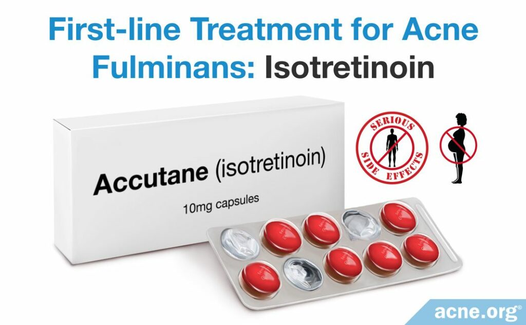 First-line Treatment for Acne Fulminans Isotretinoin