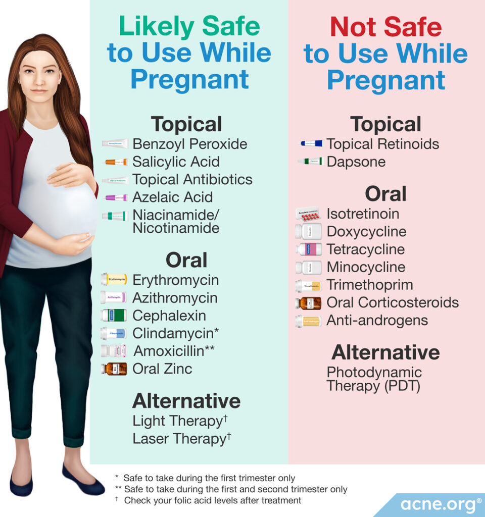 Topical, oral, and alternative acne treatments that are safe and unsafe to use while pregnant