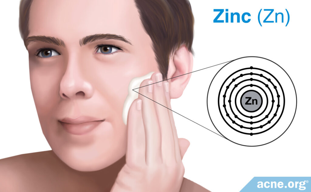 Can Topical Zinc Improve Acne?