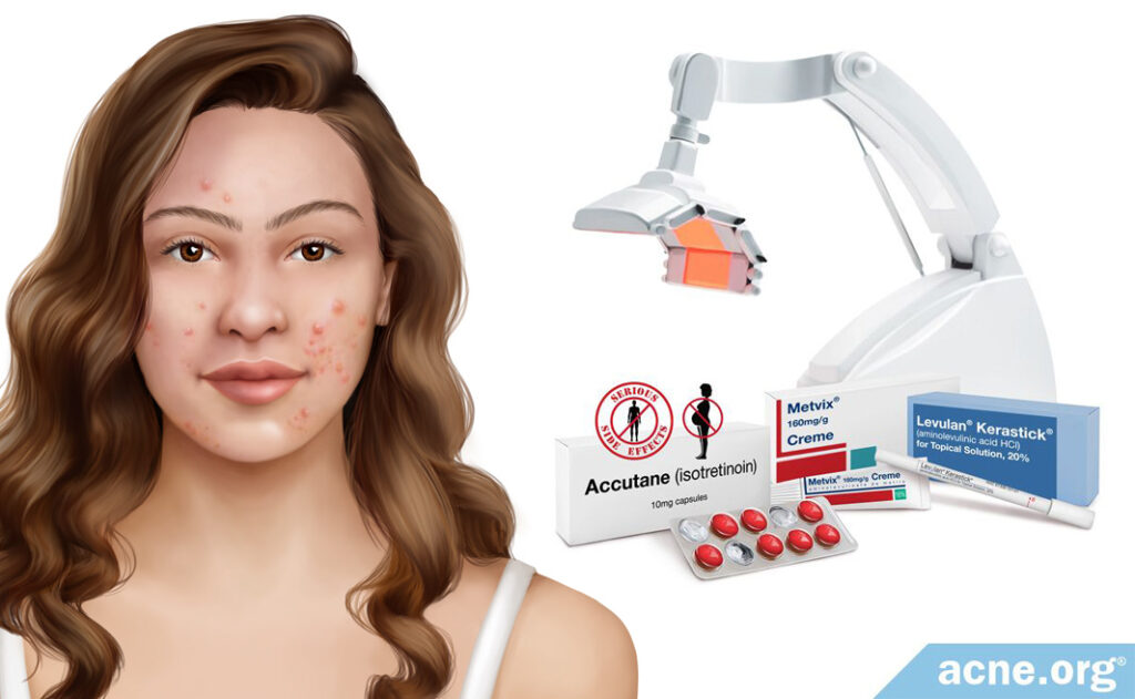 Treatments Archives Page 3 of 12