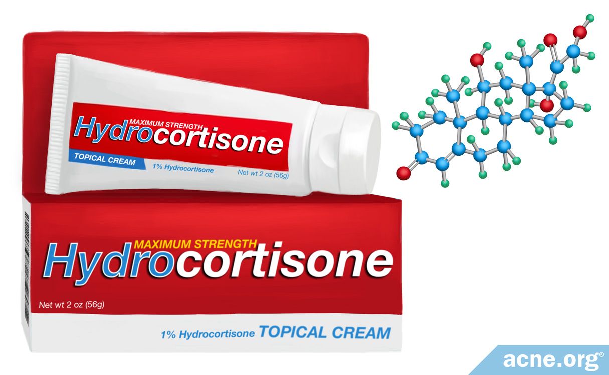 Can Topical Hydrocortisone Help With Acne