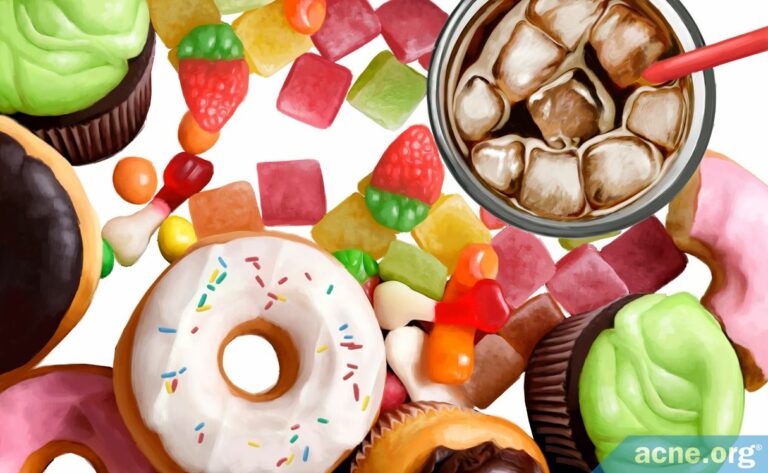 Do Sugary Foods And Drinks Cause Acne Acne do-sugary-foods-and-drinks-cause-acne-acne