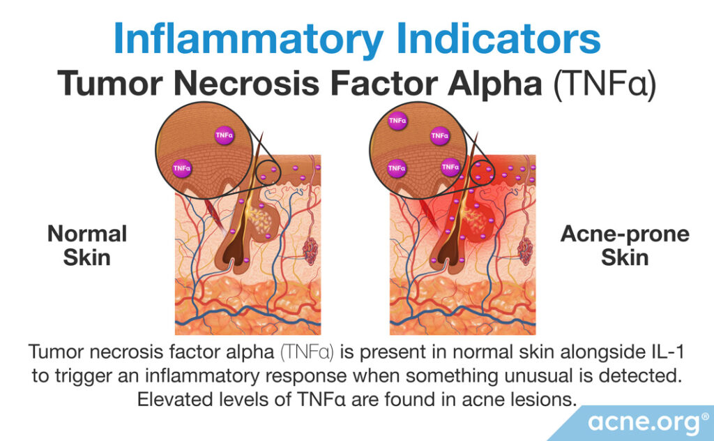 Inflammatory Indicators: Tumor Necrosis Factor Alpha (TNFalpha)