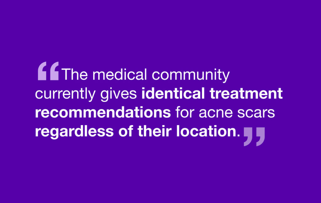 The medical community currently gives identical treatment recommendations for acne scars regardless of their location.