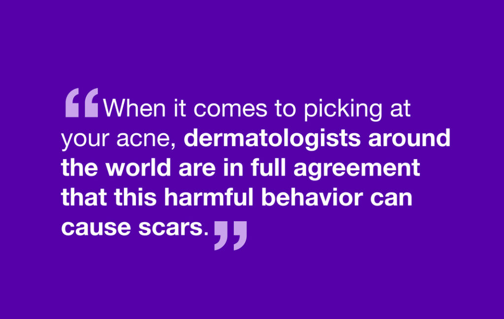 When it comes to picking at your acne, dermatologists around the world are in full agreement that this harmful behavior can cause scars