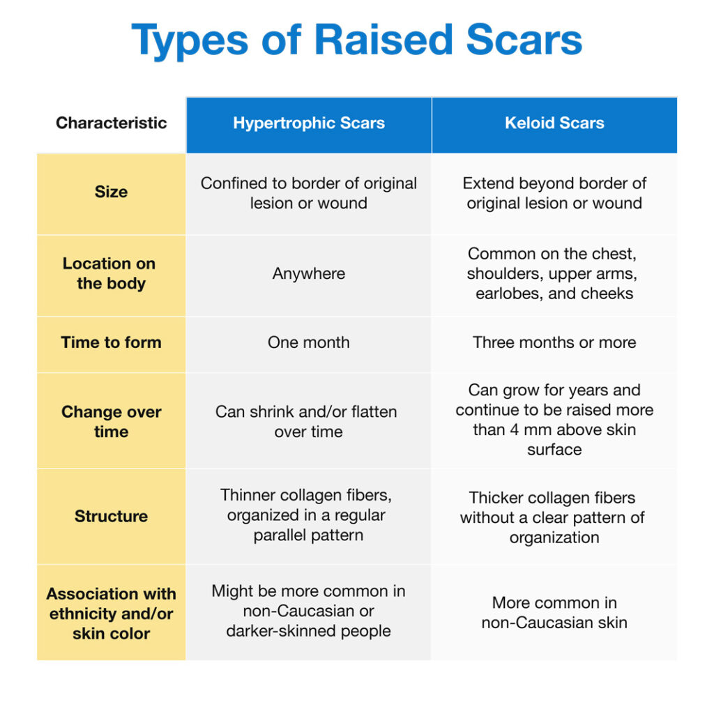 Differences between hypertrophic and keloid scars