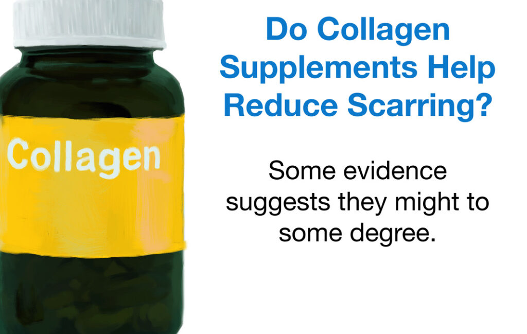 Do collagen supplements help reduce scarring?