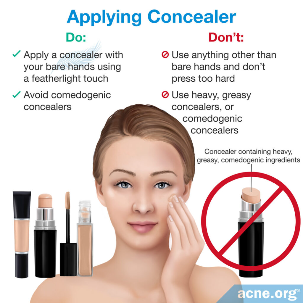 Applying Concealer to Acne-prone Skin