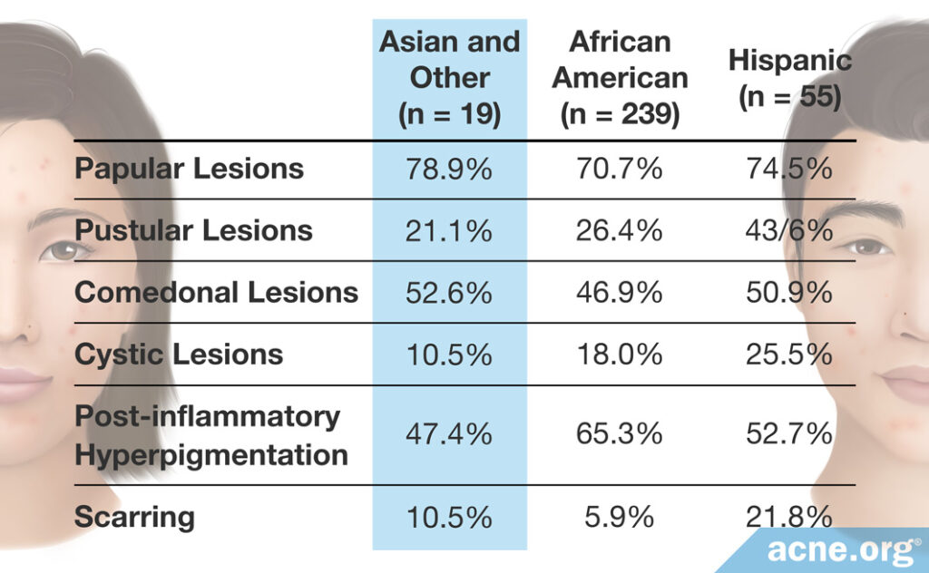 Types of Acne by Ethnicity