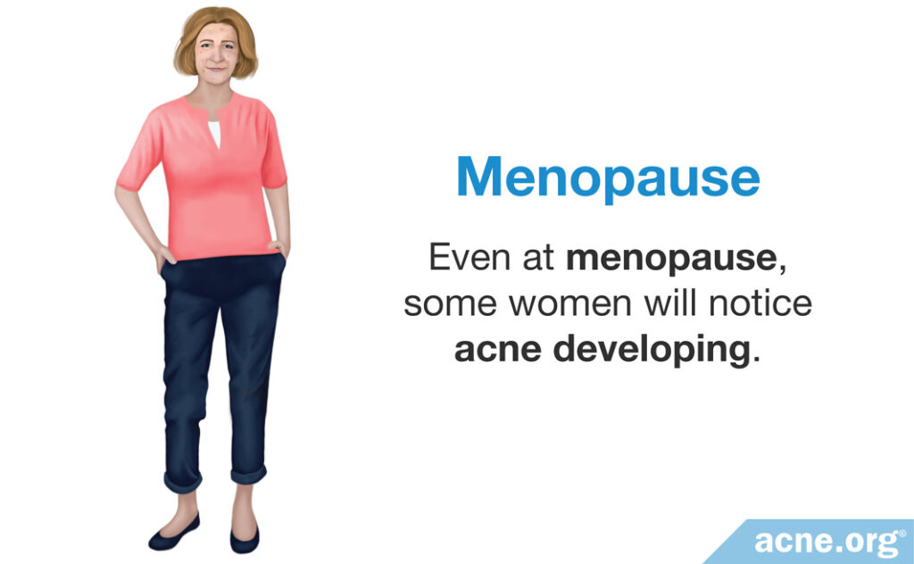 Even at menopause, some women will notice acne developing.