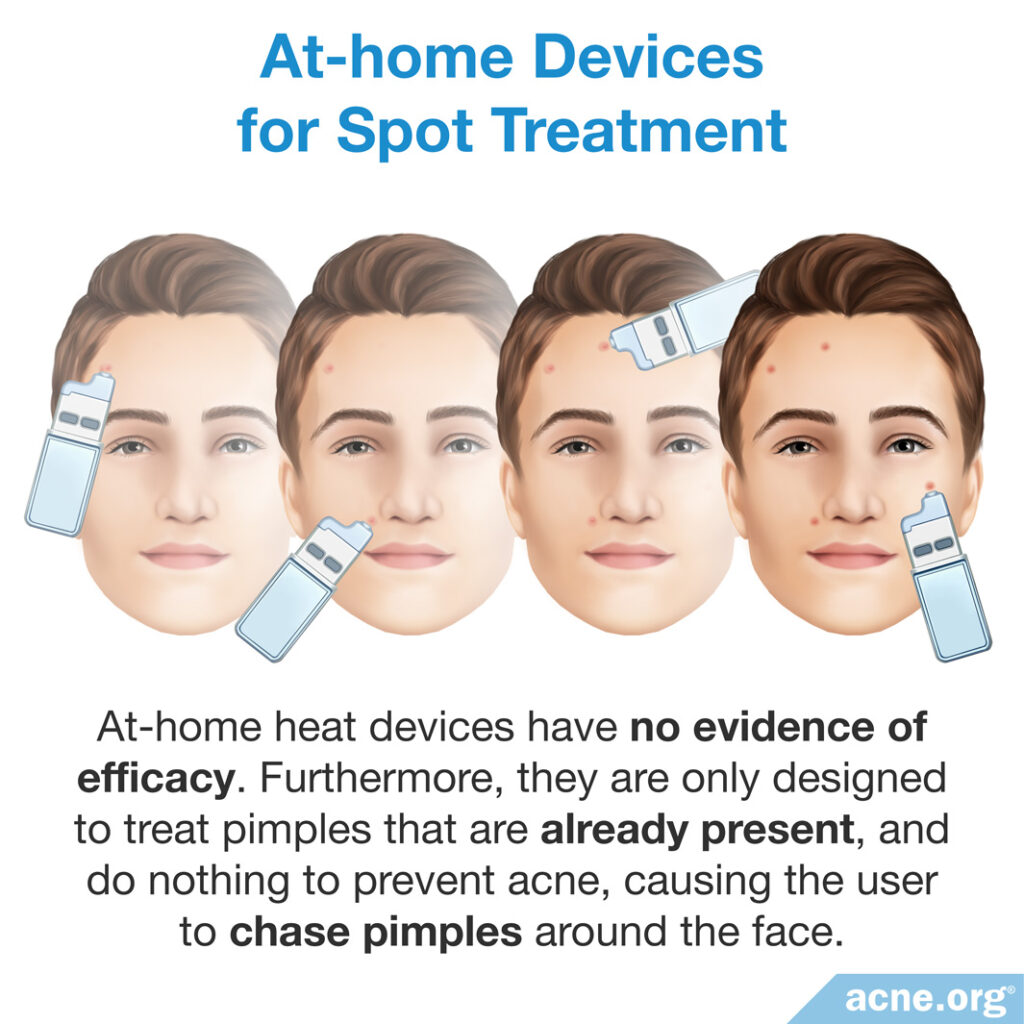 At-home Devices for Spot Treatment