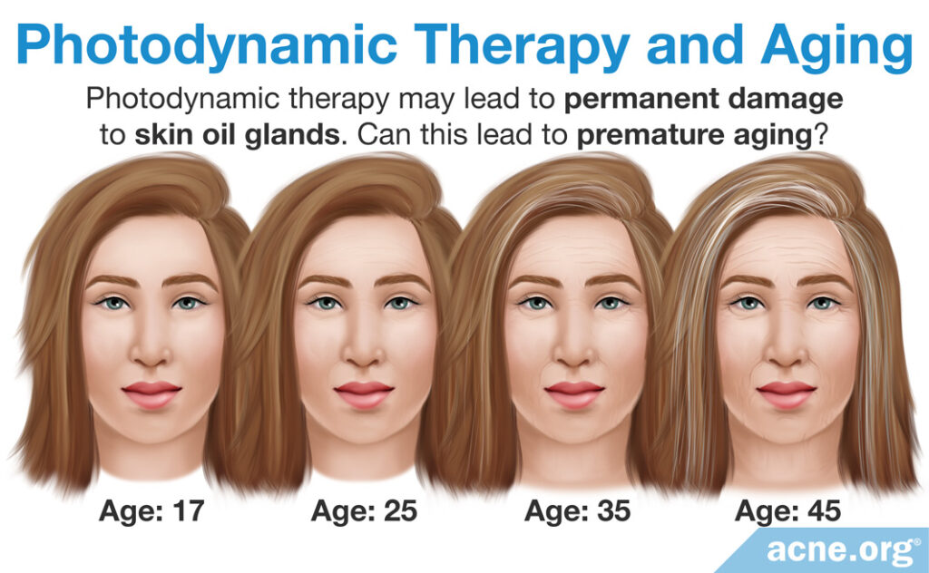 Photodynamic Therapy and Aging
