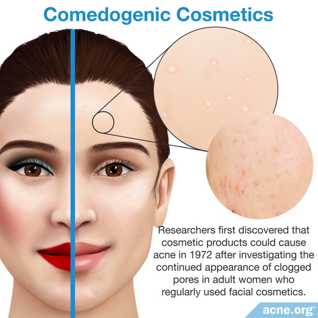Comedogenic Cosmetics