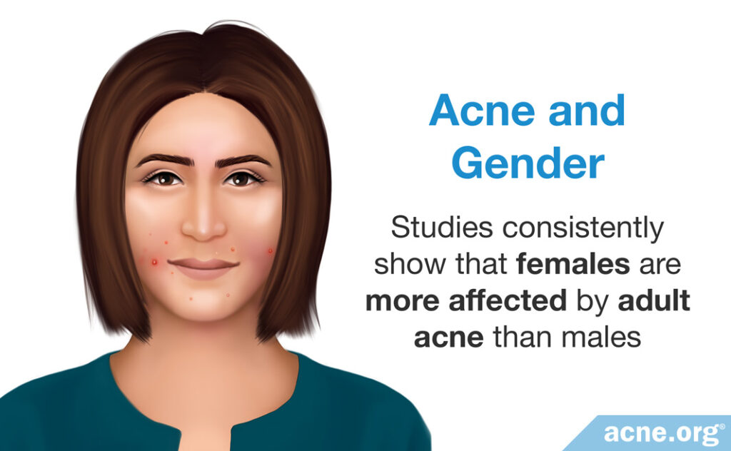 Acne and Gender