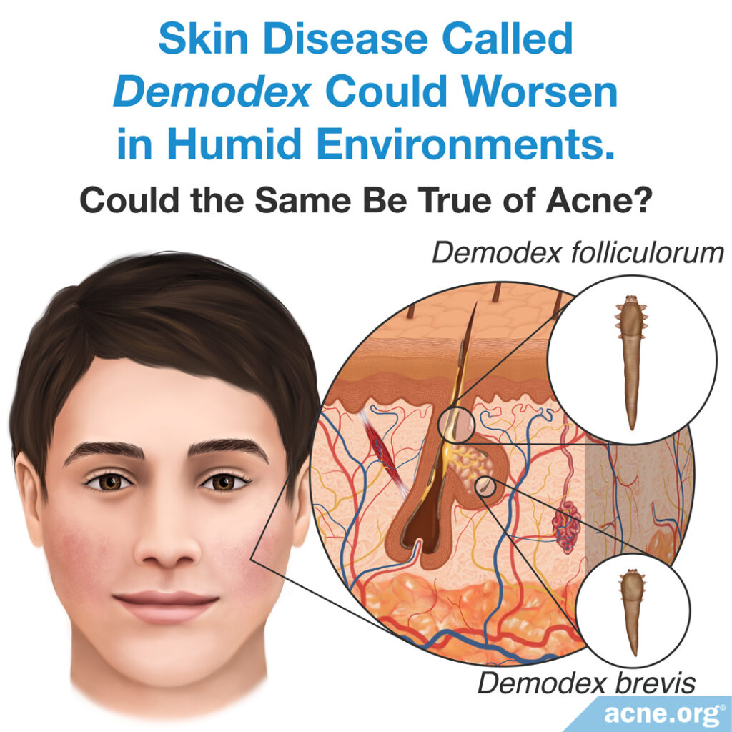 Skin Disease Called Demodex Could Worsen in Humid Environments