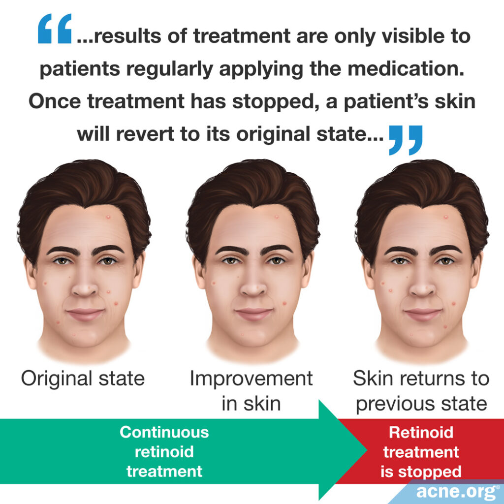 Results of treatment are only visible to patients regularly applying the medications. Once treatment has stopped, a patient's skin will revert to its original state.