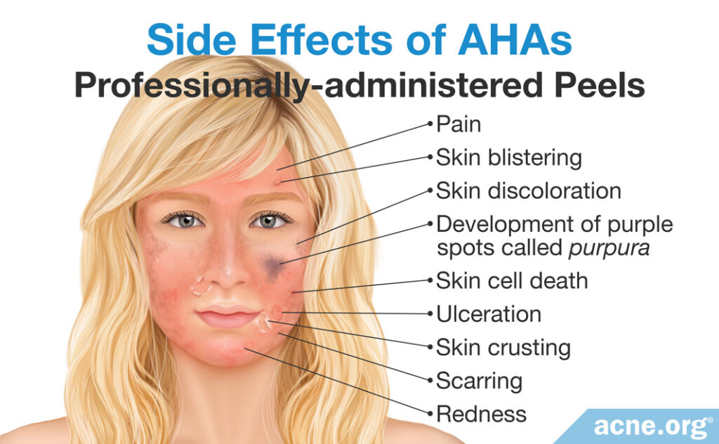 Side Effects of Professionally-administered AHA Peels