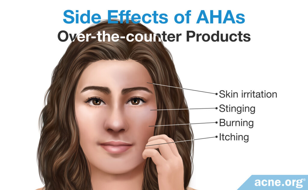 Side Effects of Over-the-counter AHA Products
