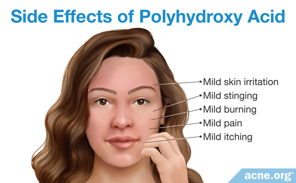 Side Effects of Polyhydroxy Acid