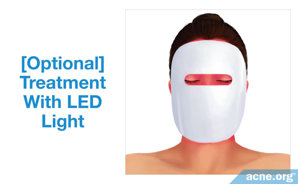 Optional Treatment With LED Light