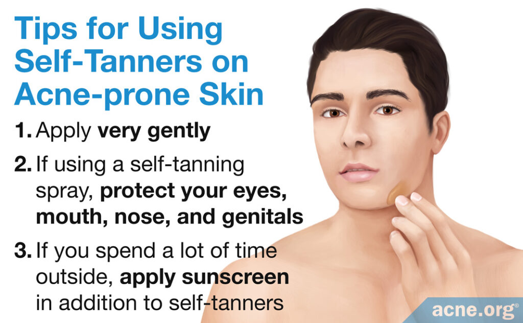 Tips for Using Self-Tanners on Acne-prone Skin