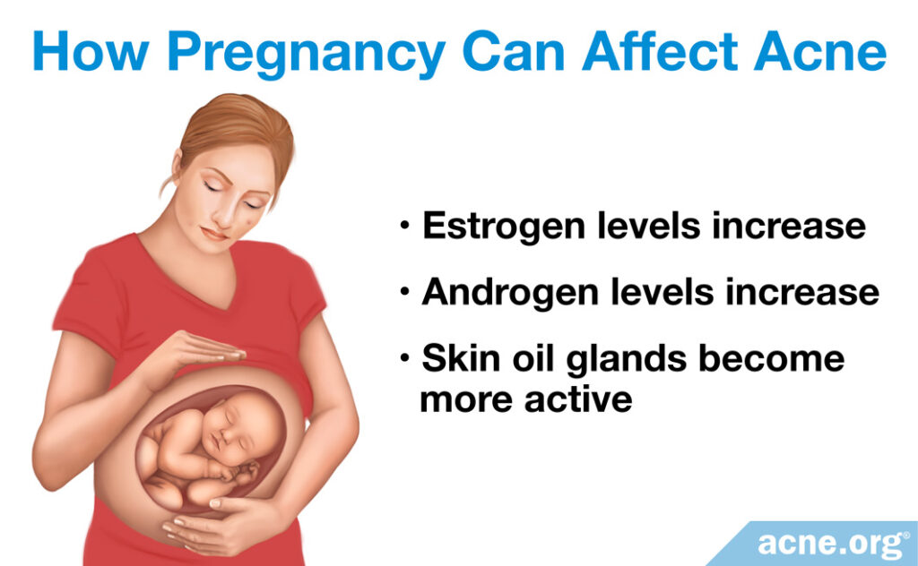 How Pregnancy Can Affect Acne