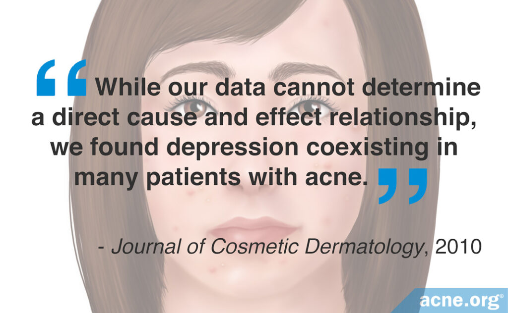 We Found Depression Coexisting in Many Patients with Acne