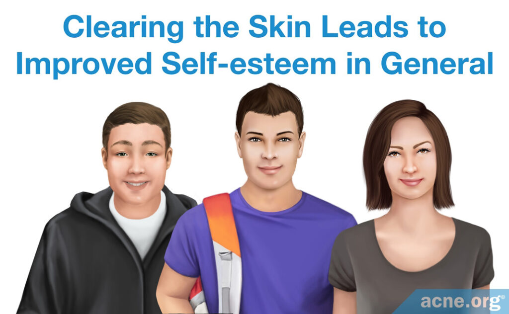 Clearing the Skin Leads to Improved Self-esteem in General