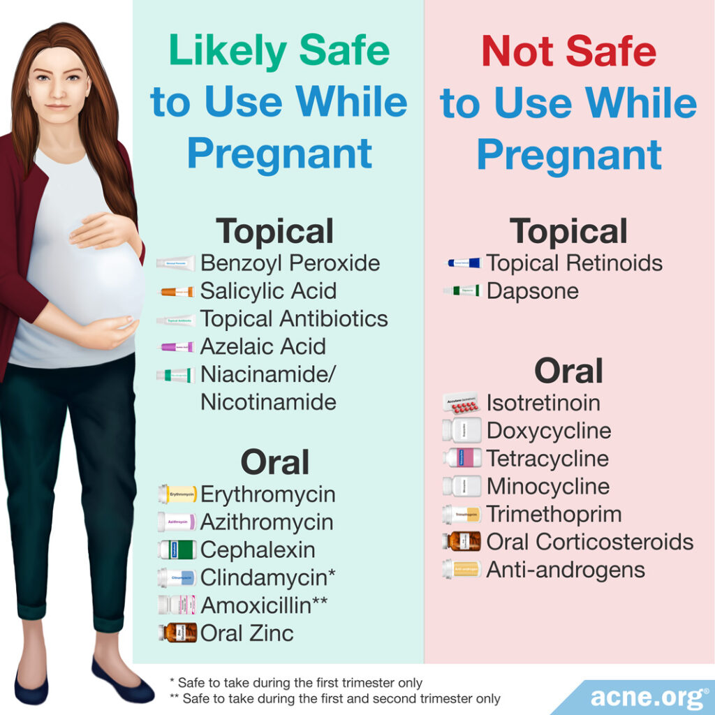 Topical and oral acne treatments that are safe and not safe to use while pregnant