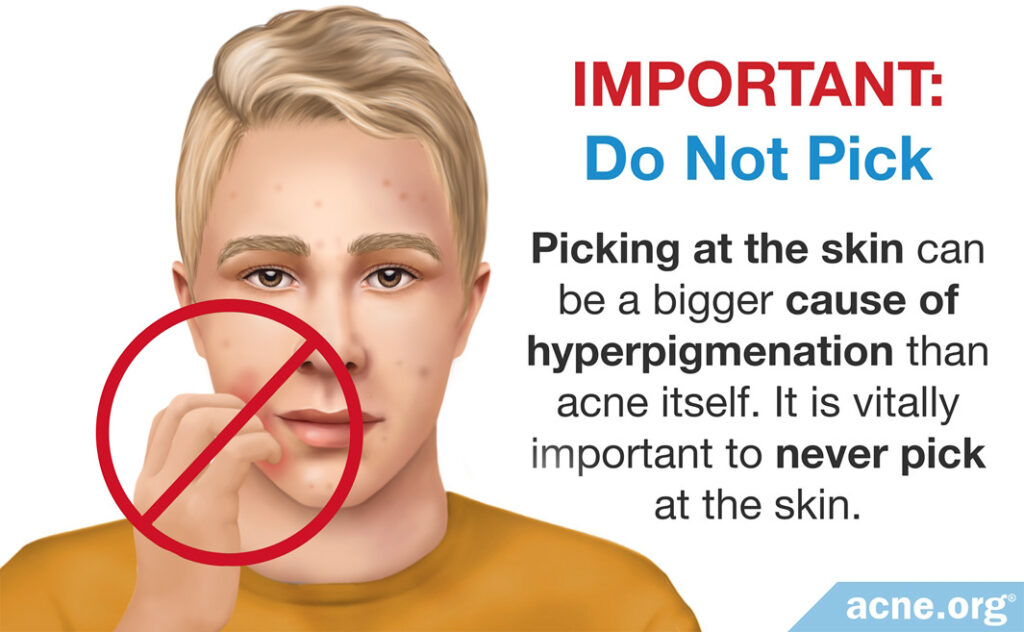 Do Not Pick the Skin