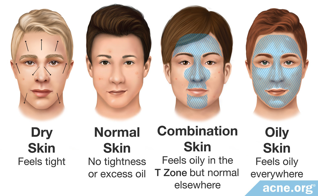 Skin Types. Dry to oily Skin. Oily Dry normal Skin. Skin Types: normal, oily, Dry, and combination.. Skin many