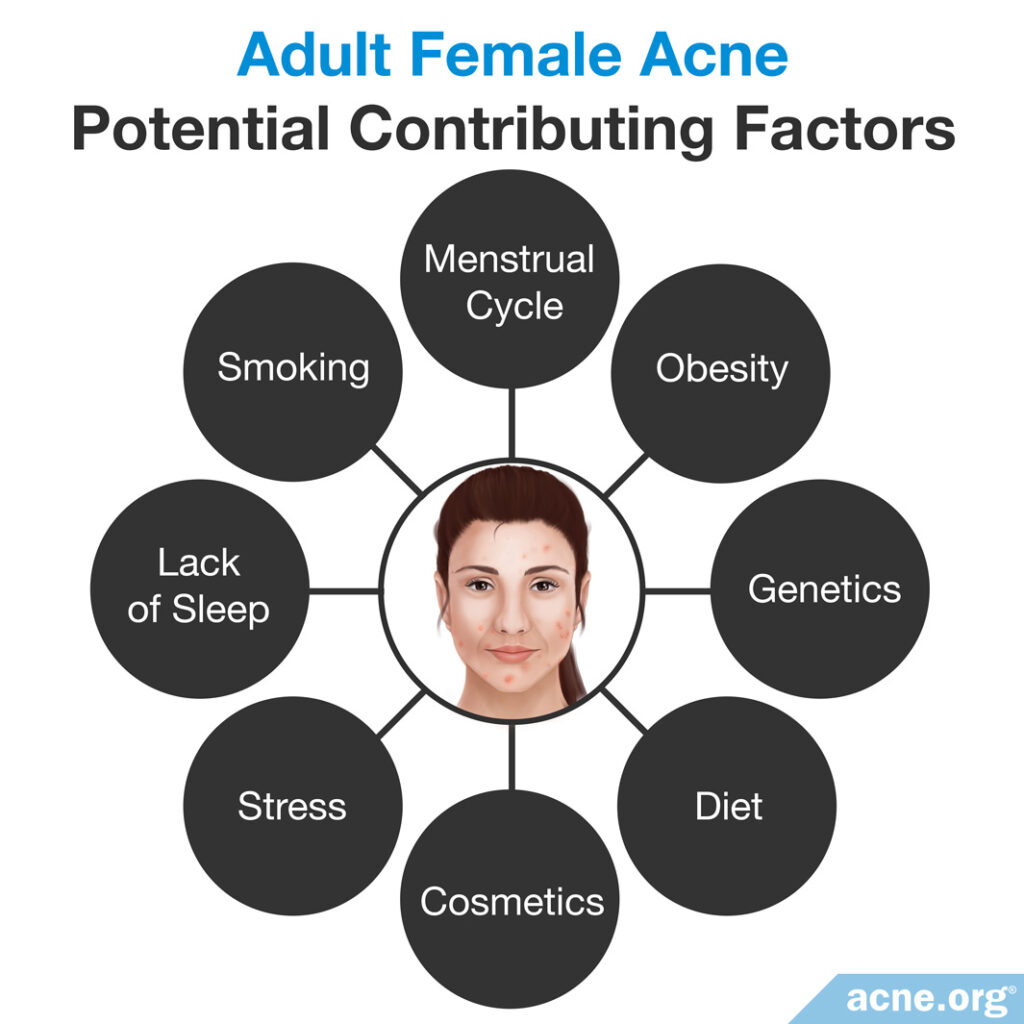 Adult Female Acne: Potential Contributing Factors