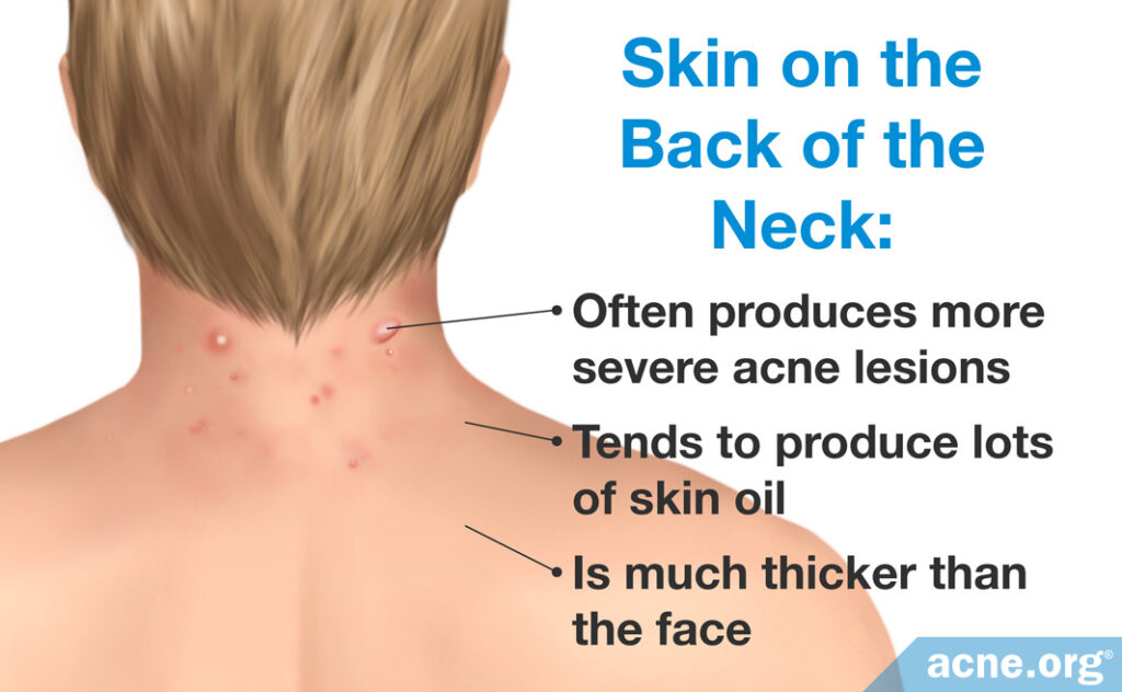 Skin on the Back of the Neck