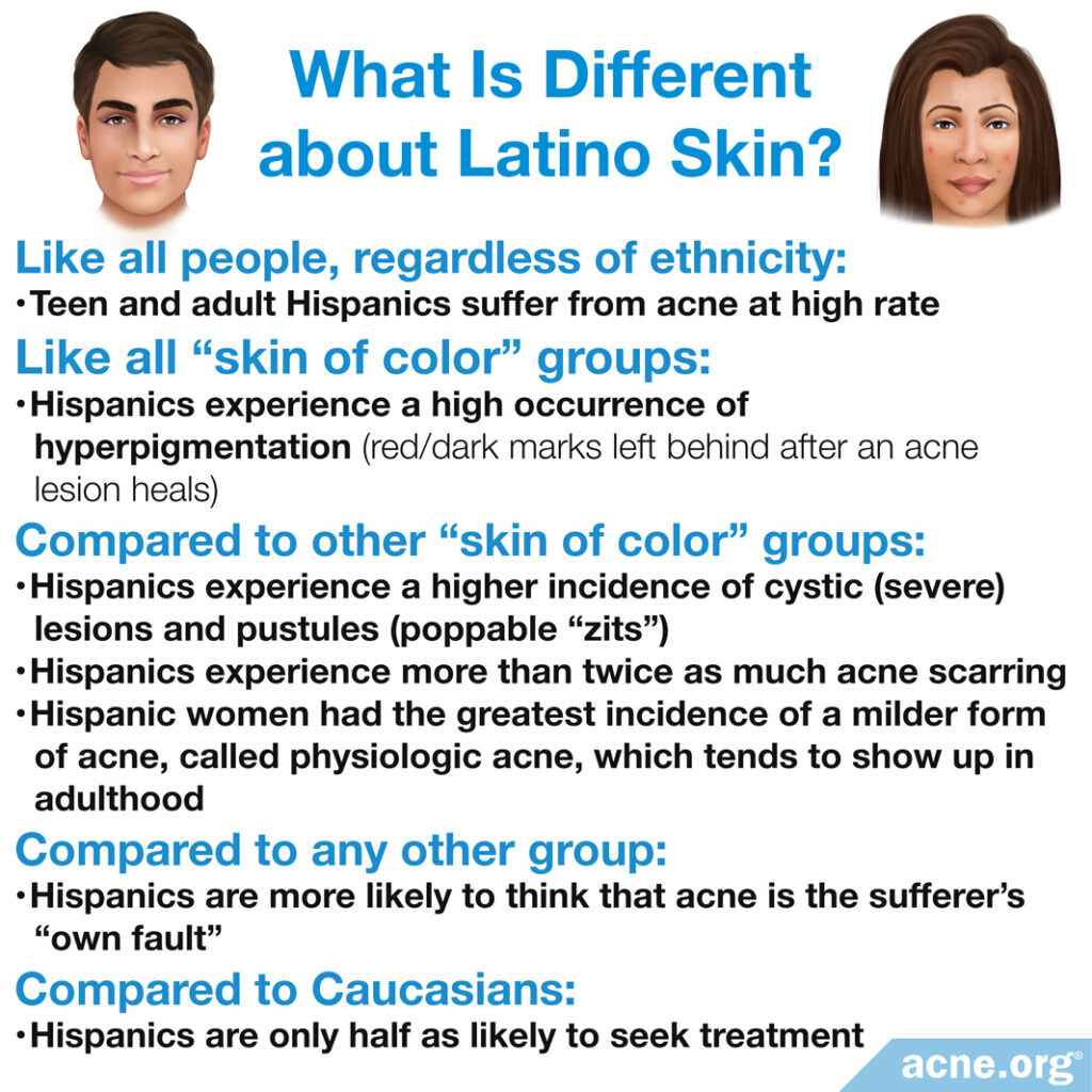 What is different about Latino skin?