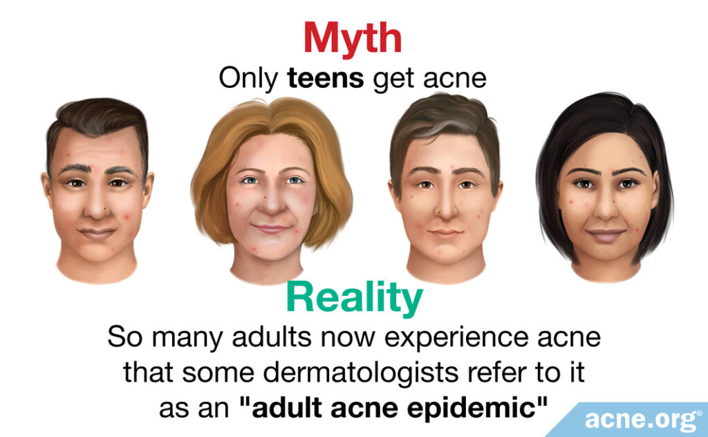 Myth: only teens get acne