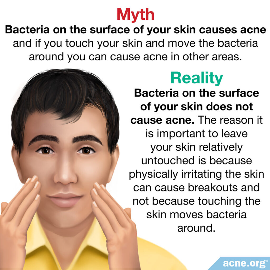 Myth: bacteria on the surface of your skin causes acne